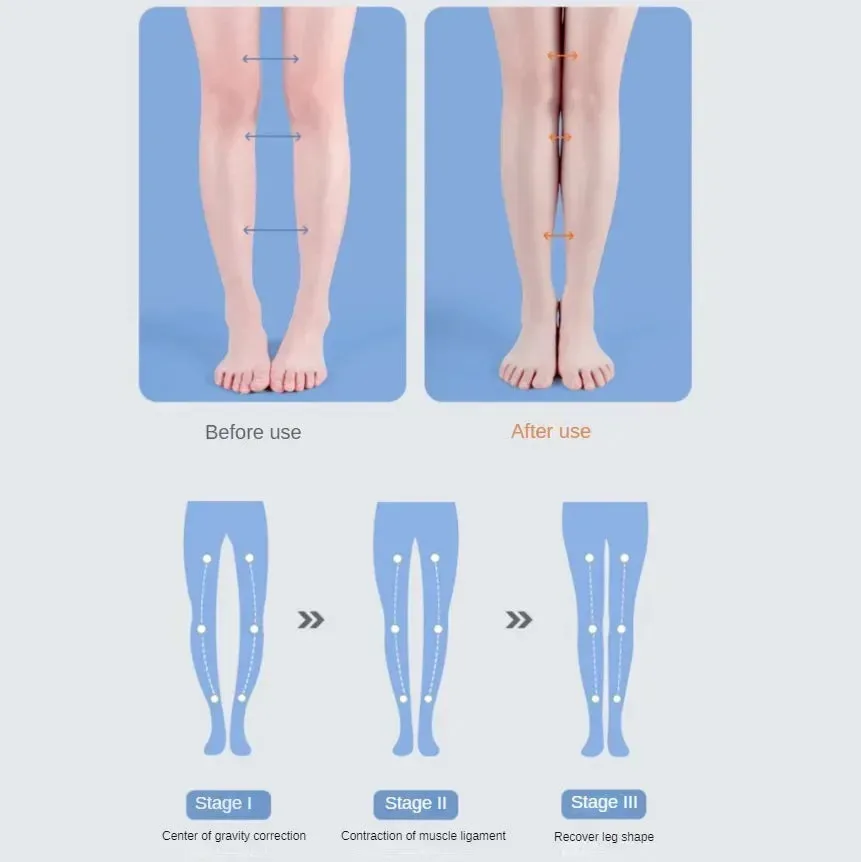 Breathable Orthotic PU Shoe Inserts Soft Shoe Pad