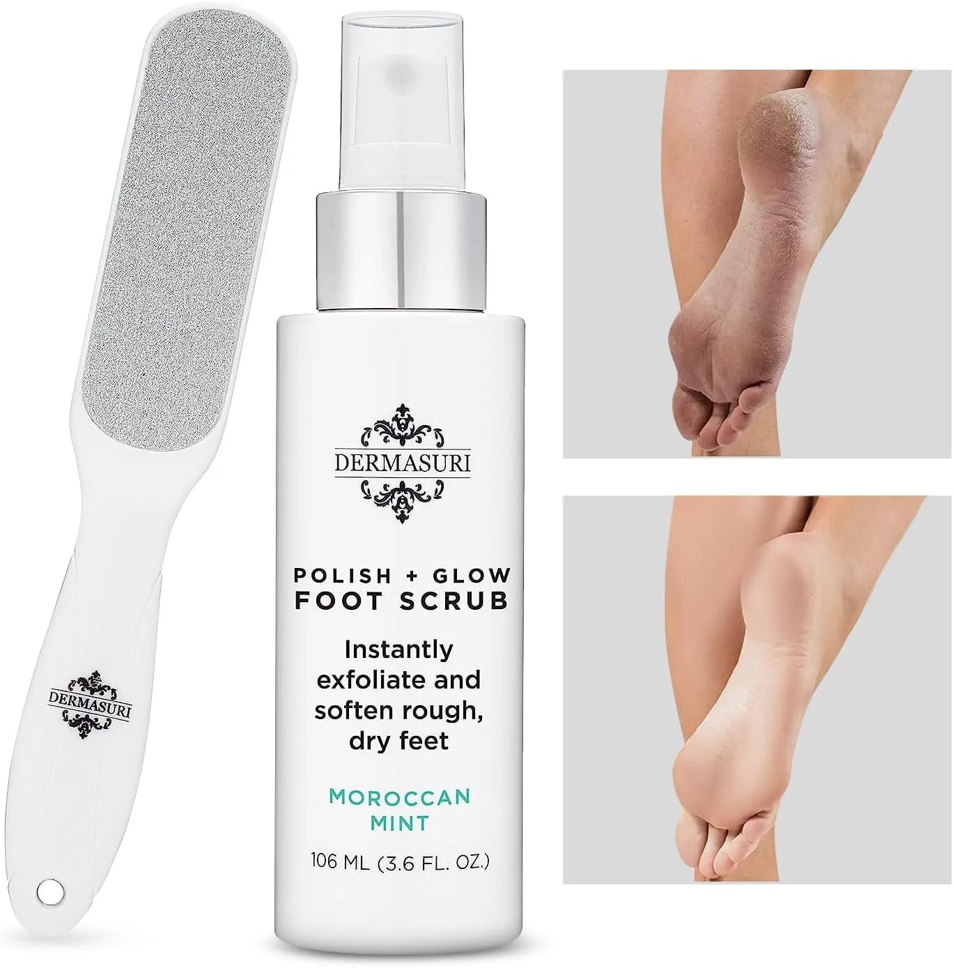 Callus Remover Foot Scrub - Exfoliating Feet Spray-On Formula and Reusable Deluxe Sole File Valentines Gift Set - Dead Skin Remover, Peel & Soften Cracked Heels - Deluxe Pedicure Spa Kit